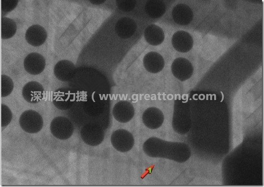 BGA因?yàn)楹笁|變小，造成錫膏過多而最終形成焊接短路的結(jié)果。